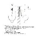 AP30-WLS_DessinTechnique.webp